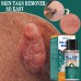 Flat and sharp warts, with a warm and moisturizing facial warts remover